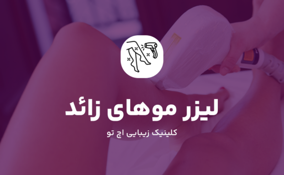 لیزر موهای زائد