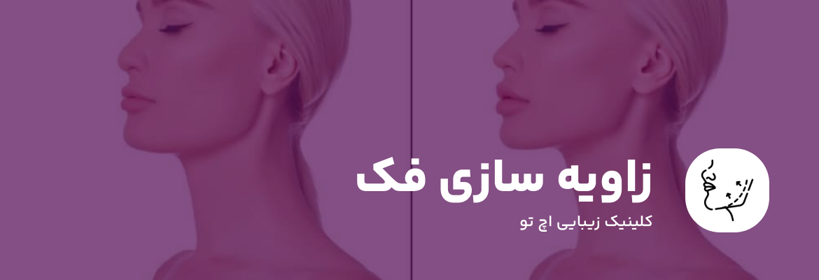 زاویه سازی فک با فیلر