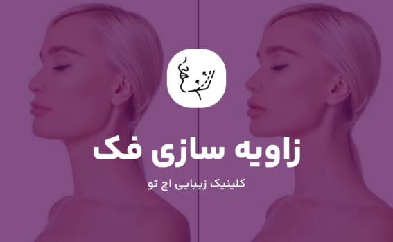 زاویه سازی فک