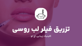 تزریق ژل لب روسی