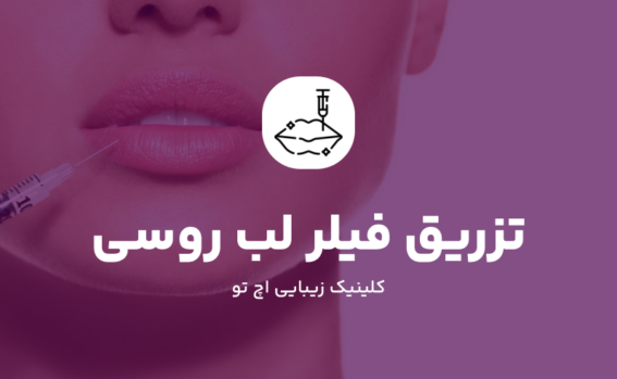 تزریق ژل لب روسی