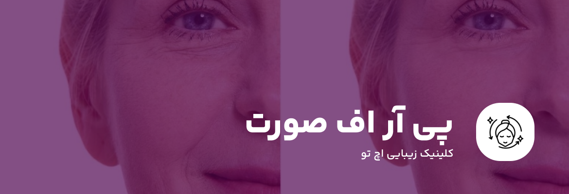 پی آر اف صورت چیست؟