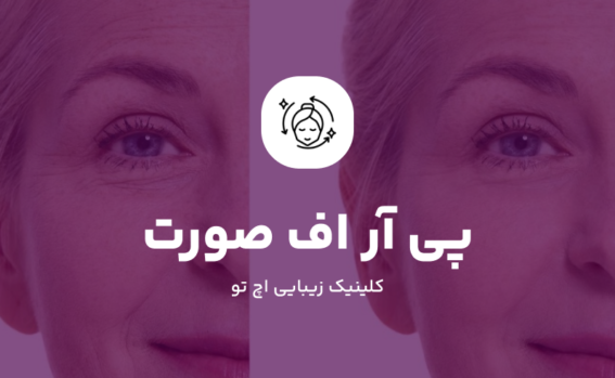 PRF صورت چیست؟