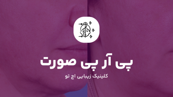 PRP صورت چیست؟