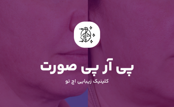 PRP صورت چیست؟