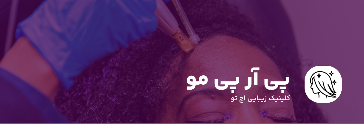 تزریق پی آر پی مو