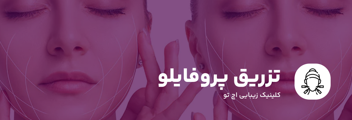 تزریق پروفایلو در تهران