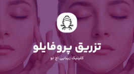 تزریق پروفایلو در شمال تهران