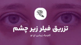 تزریق فیلر زیر چشم چیست؟