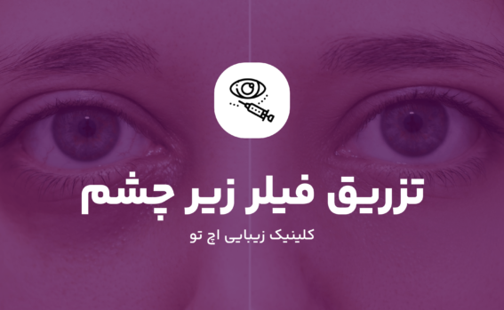 تزریق فیلر زیر چشم چیست؟
