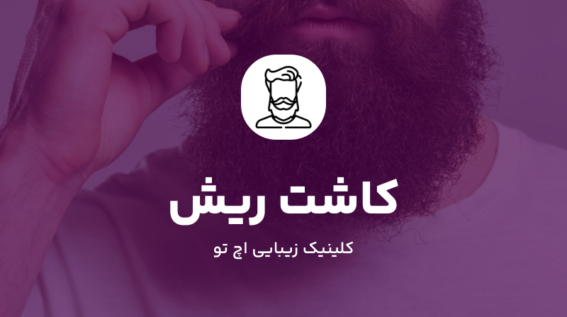 کاشت ریش و سبیل در شمال تهران