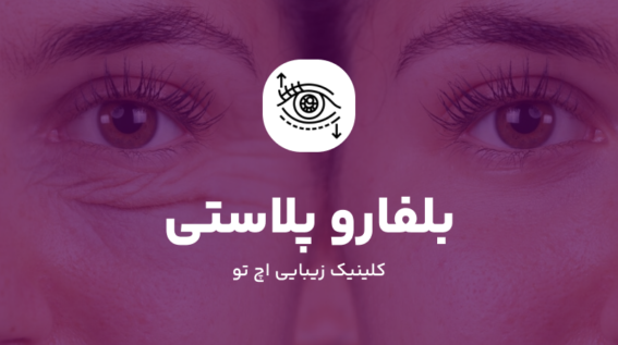 جراحی بلفاروپلاستی در شمال تهران