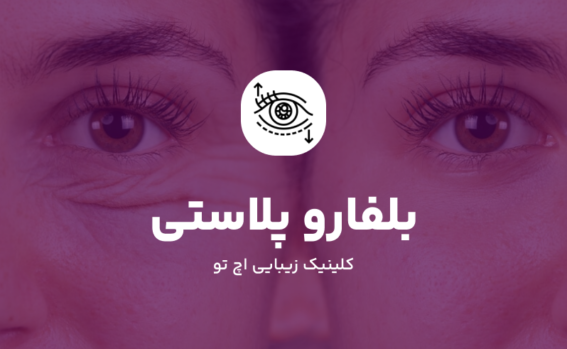 جراحی بلفاروپلاستی در شمال تهران