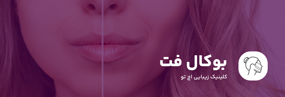 جراحی بوکال فت در شمال تهران