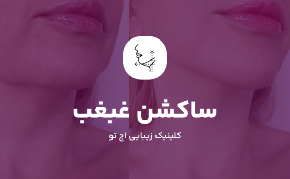 ساکشن غبغب در شمال تهران