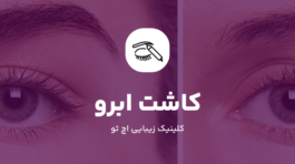 کاشت ابرو در شمال تهران
