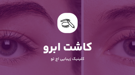 کاشت ابرو در شمال تهران