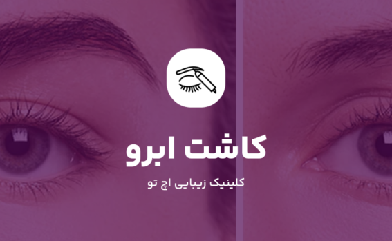 کاشت ابرو در شمال تهران