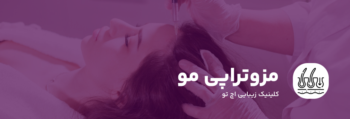 مزوتراپی مو در تهران
