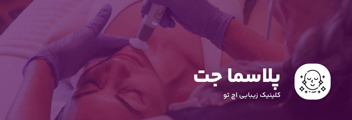 پلاسما جت چیست