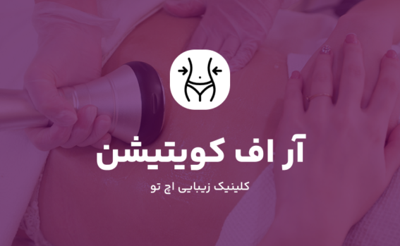 آر اف کویتیشن در شمال تهران