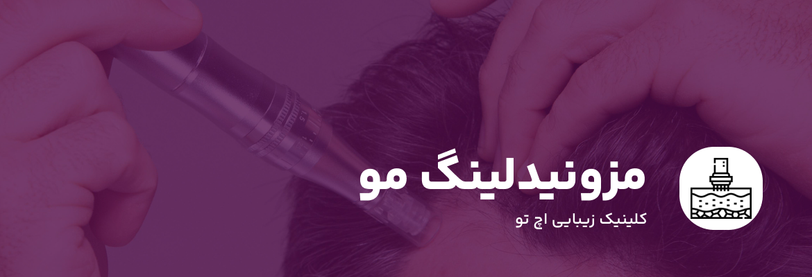 مزونیدلینگ مو چیست