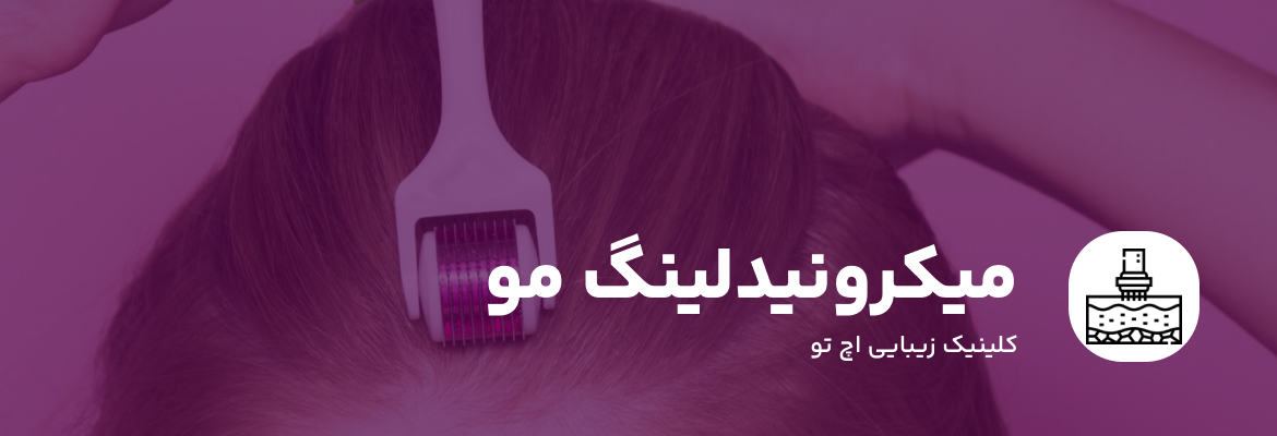 میکرونیدلینگ مو چیست