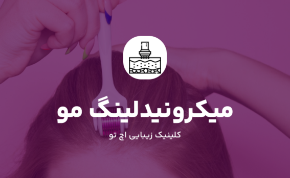میکرونیدلینگ مو چیست