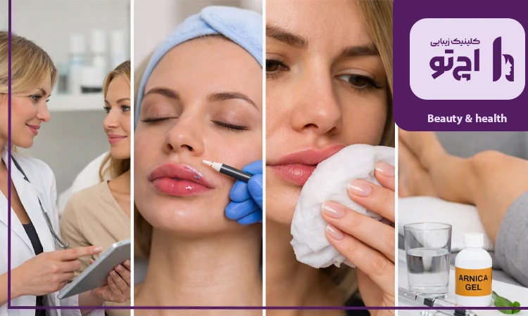 راهکارهای پیشگیری از نامتقارن شدن لب