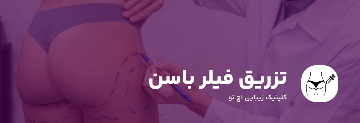 تزریق فیلر باسن در تهران
