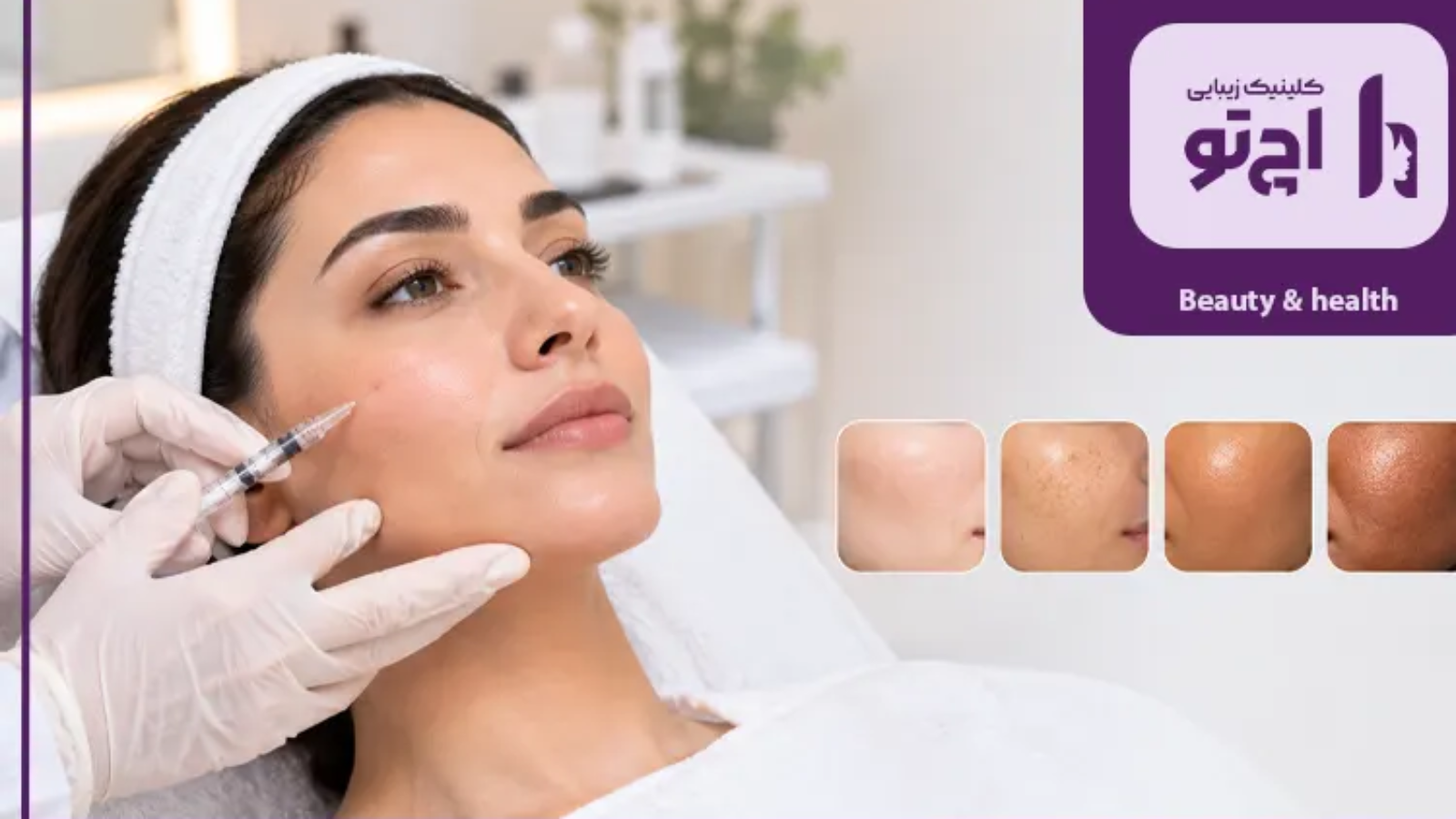 بررسی انواع پوست مناسب تزریق PLLA