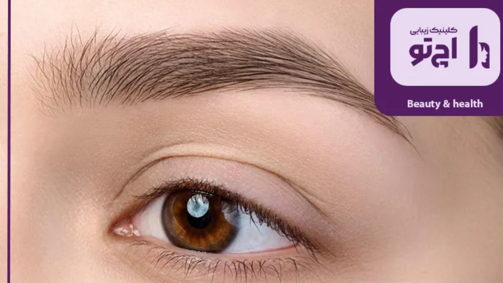 کاشت ابرو ابروهای کم پشت ارثی